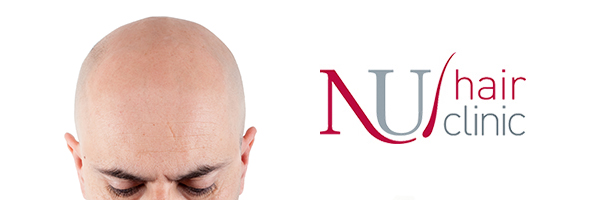 FUT hair transplant in Nottingham 